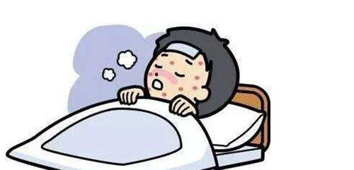 感染水痘别用激素类药膏治疗