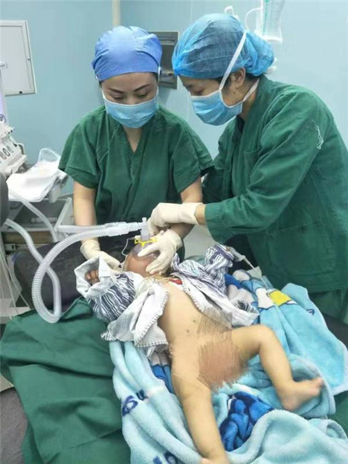 4个月大患儿麻醉手术 德阳援彝医生全程手控呼吸