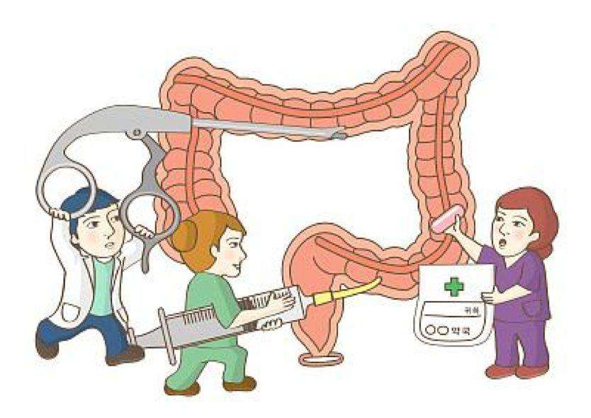 科学应对放射性直肠炎
