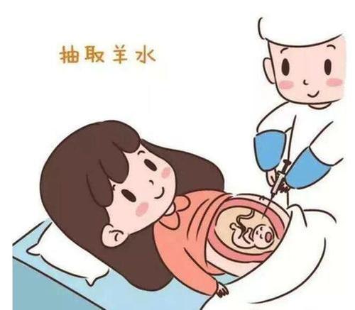 “羊水穿刺”那些事