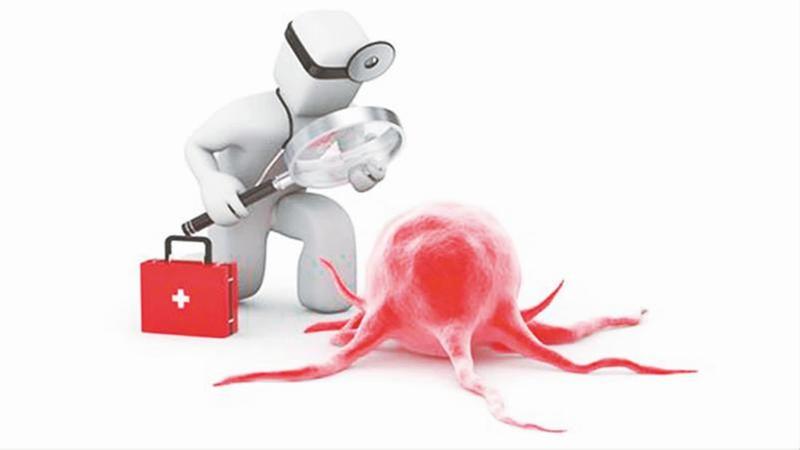 胆管癌——罕见的腺癌