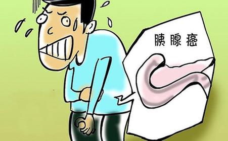 胰腺癌早期诊断很重要