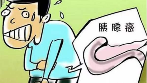 胰腺癌早发现、早诊断很重要