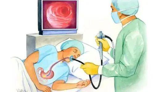 发现早期胃癌的“金标准”——胃镜检查（上）