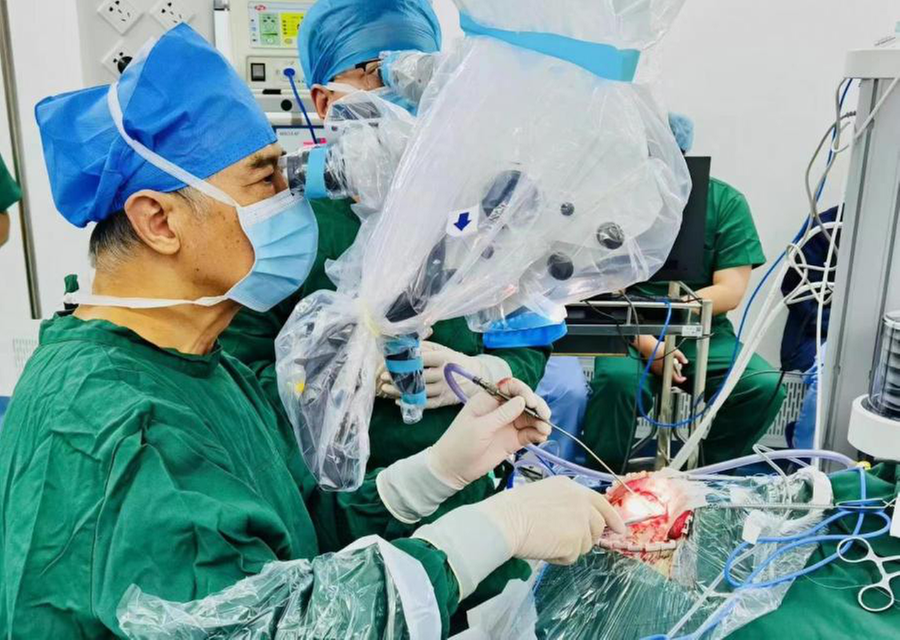 风险极高的颅内超大动脉瘤被成功“拆弹”