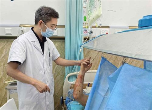 特重度烧伤患者“浴火重生”